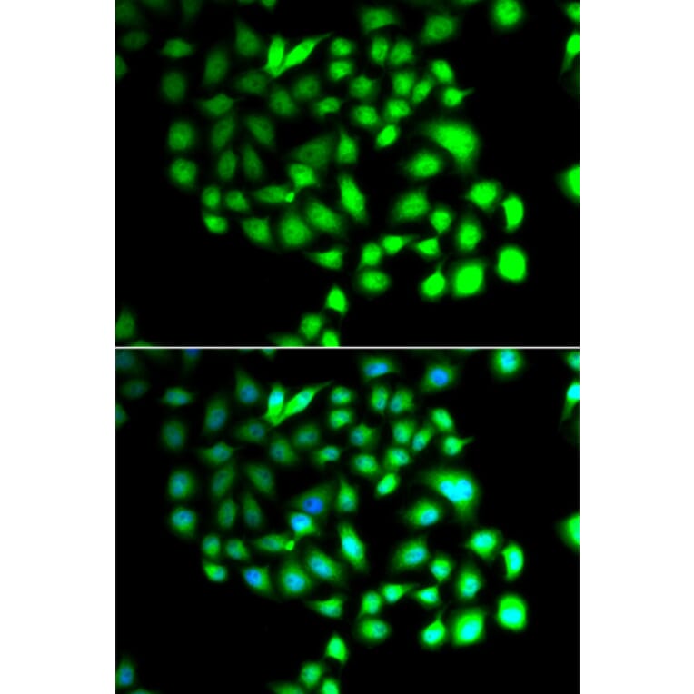 Immunofluorescence - Anti-TCEAL8 Antibody (A7845) - Antibodies.com