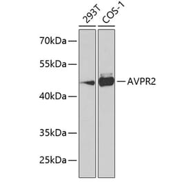 Western Blot - Anti-V2R Antibody (A10242) - Antibodies.com