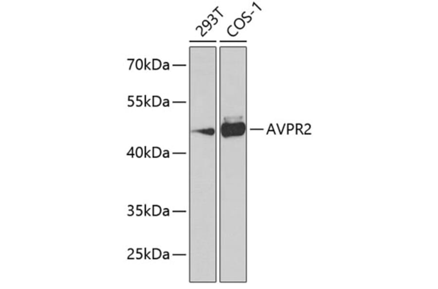 Western Blot - Anti-V2R Antibody (A10242) - Antibodies.com