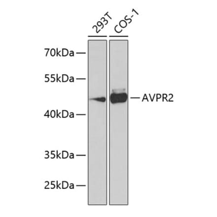 Western Blot - Anti-V2R Antibody (A10242) - Antibodies.com