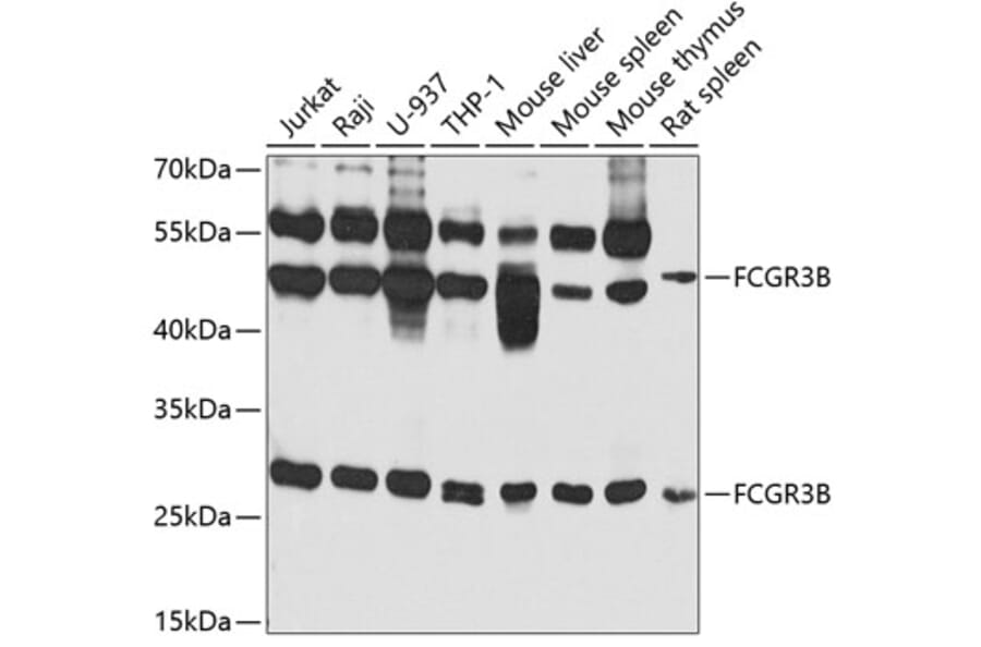 Western Blot - Anti-CD16b Antibody (A10243) - Antibodies.com