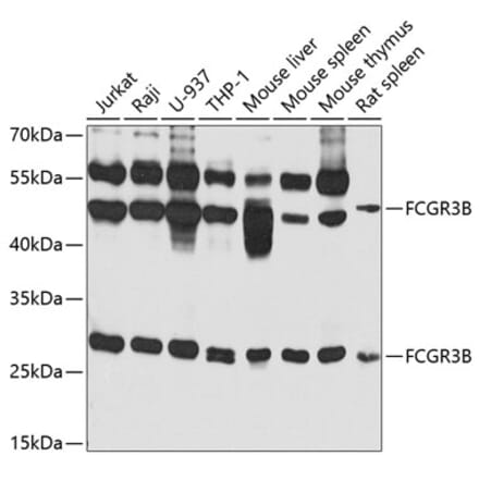Western Blot - Anti-CD16b Antibody (A10243) - Antibodies.com