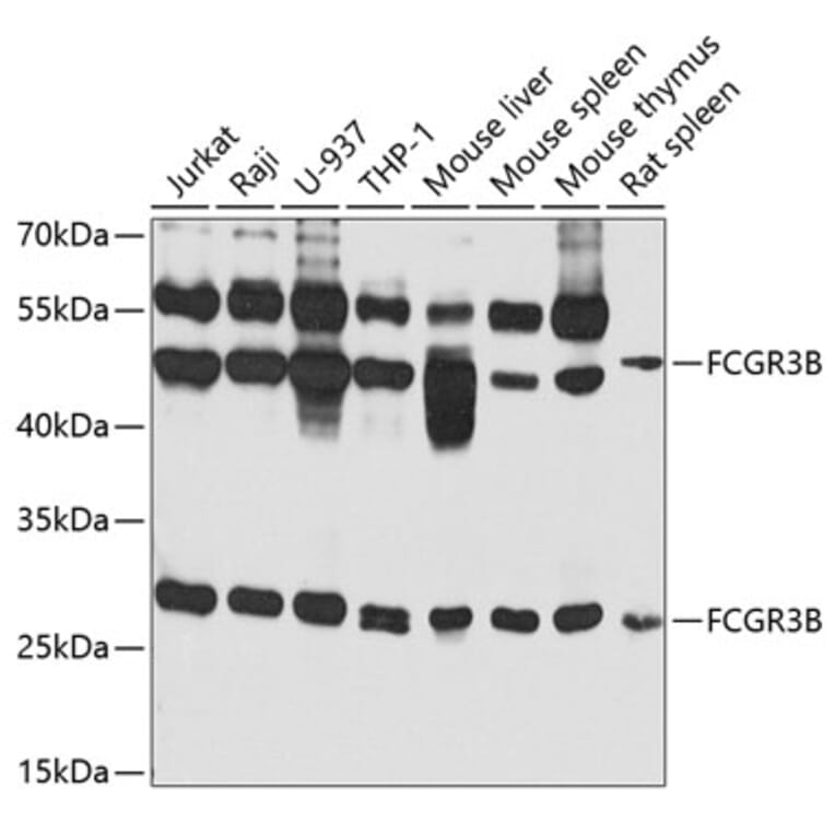 Western Blot - Anti-CD16b Antibody (A10243) - Antibodies.com