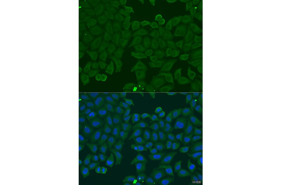 Immunofluorescence - Anti-IFNA6 Antibody (A7903) - Antibodies.com