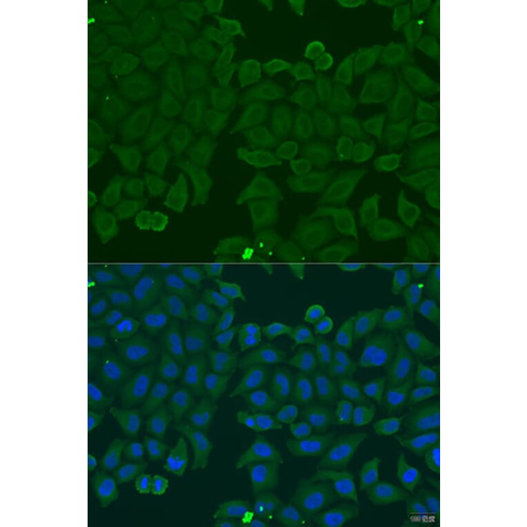 Immunofluorescence - Anti-IFNA6 Antibody (A7903) - Antibodies.com
