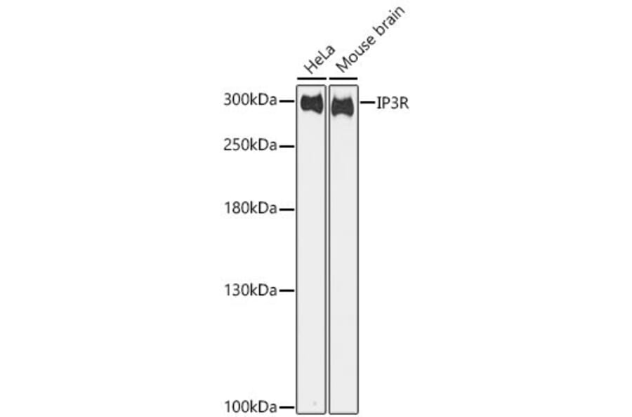 Western Blot - Anti-IP3 Receptor Antibody (A10245) - Antibodies.com