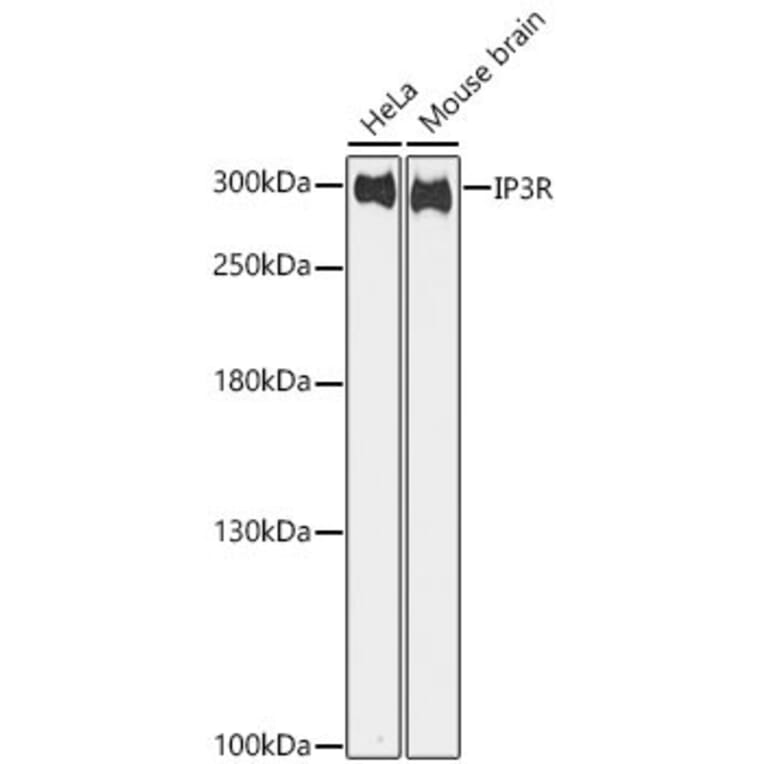 Western Blot - Anti-IP3 Receptor Antibody (A10245) - Antibodies.com