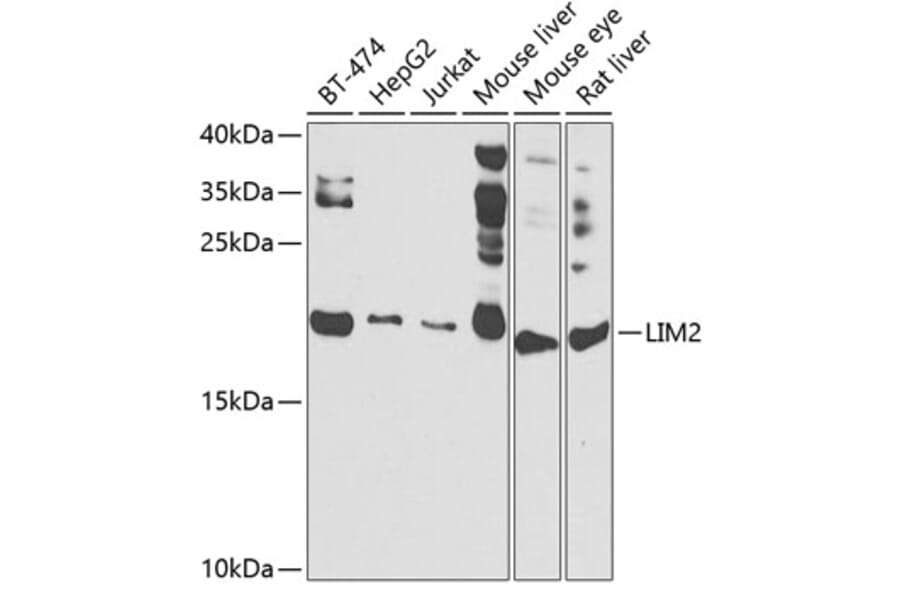 Western Blot - Anti-LIM2 Antibody (A10247) - Antibodies.com
