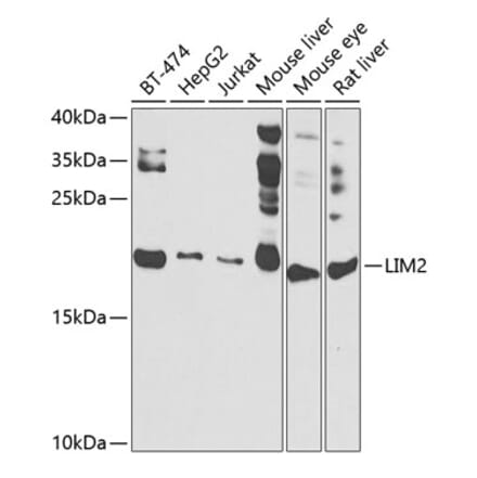 Western Blot - Anti-LIM2 Antibody (A10247) - Antibodies.com