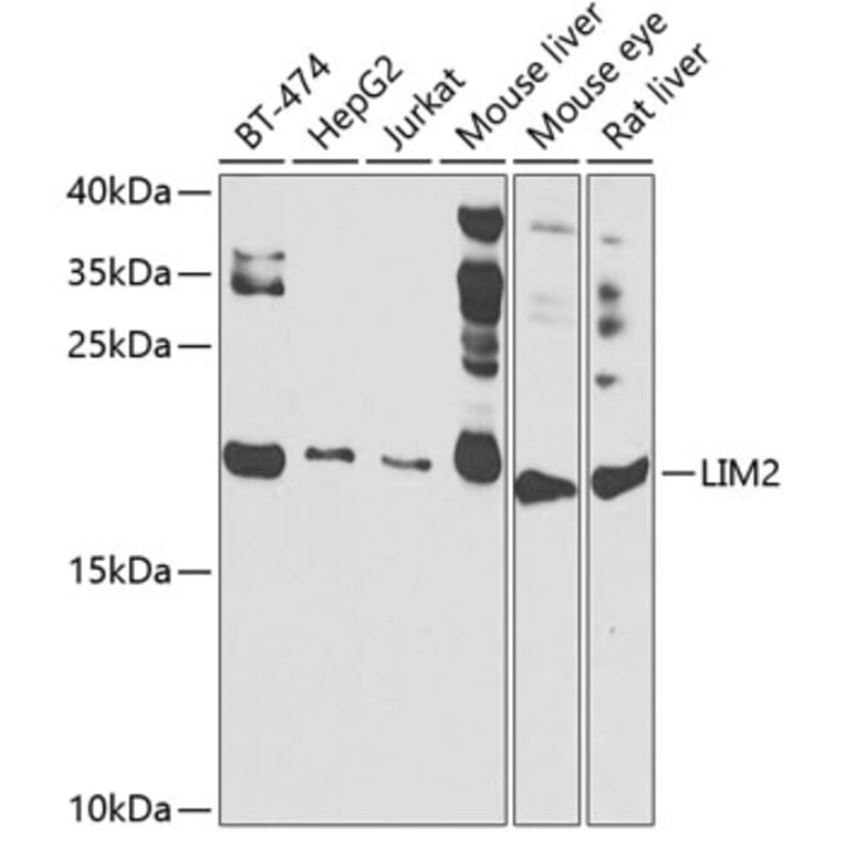 Western Blot - Anti-LIM2 Antibody (A10247) - Antibodies.com