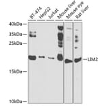 Western Blot - Anti-LIM2 Antibody (A10247) - Antibodies.com