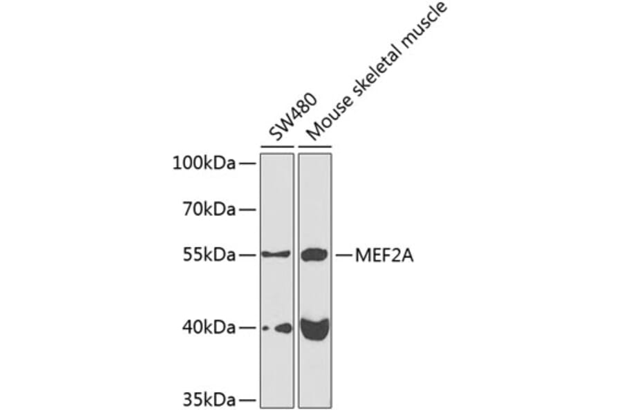 Western Blot - Anti-MEF2A Antibody (A10248) - Antibodies.com
