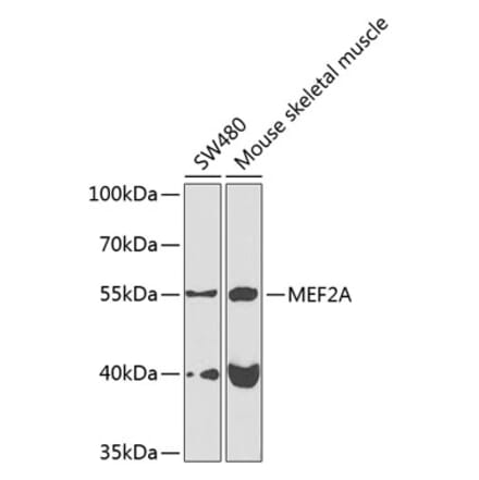 Western Blot - Anti-MEF2A Antibody (A10248) - Antibodies.com