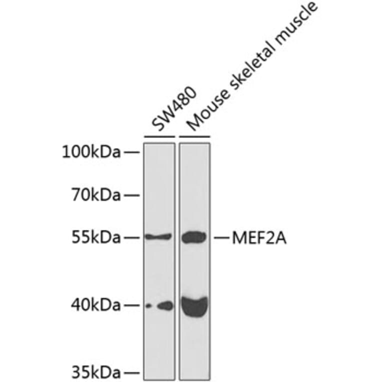 Western Blot - Anti-MEF2A Antibody (A10248) - Antibodies.com