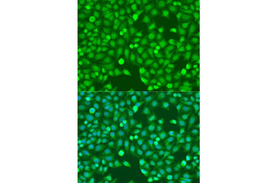 Immunofluorescence - Anti-MEF2A Antibody (A10248) - Antibodies.com