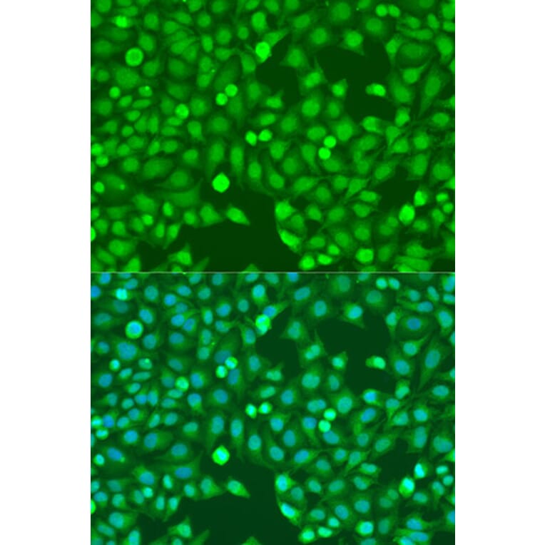 Immunofluorescence - Anti-MEF2A Antibody (A10248) - Antibodies.com