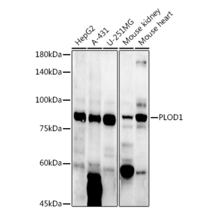 Western Blot - Anti-LH1 Antibody (A10250) - Antibodies.com