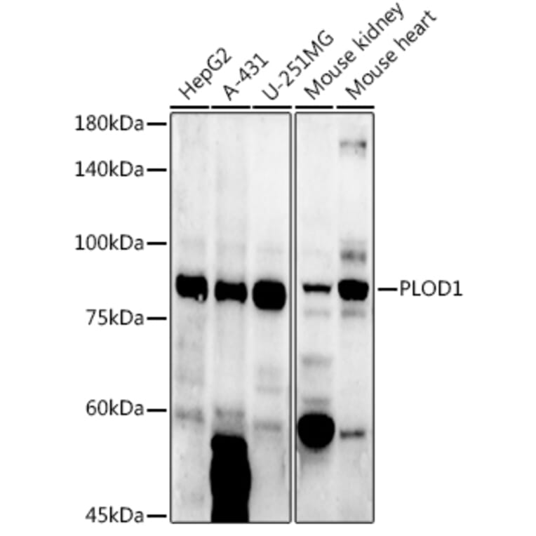 Western Blot - Anti-LH1 Antibody (A10250) - Antibodies.com