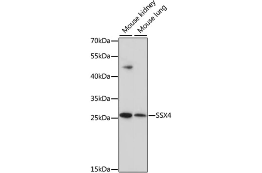 Western Blot - Anti-SSX4 Antibody (A10252) - Antibodies.com