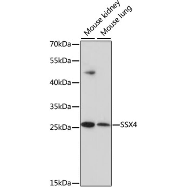 Western Blot - Anti-SSX4 Antibody (A10252) - Antibodies.com