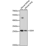 Western Blot - Anti-SSX4 Antibody (A10252) - Antibodies.com