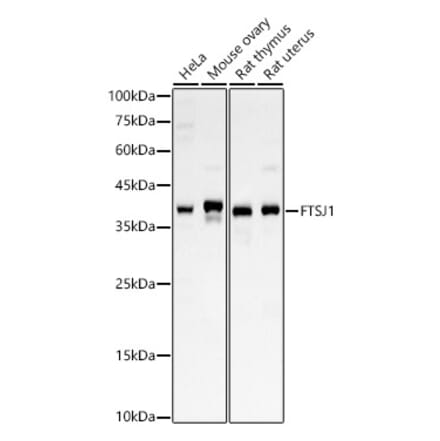 Western Blot - Anti-FTSJ1 Antibody (A10255) - Antibodies.com