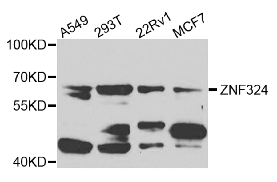 Western Blot - Anti-ZNF324 Antibody (A7968) - Antibodies.com