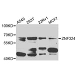 Western Blot - Anti-ZNF324 Antibody (A7968) - Antibodies.com