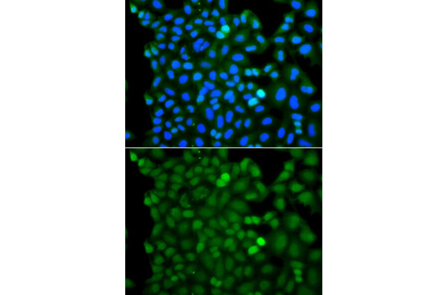 Immunofluorescence - Anti-RNF125 Antibody (A7982) - Antibodies.com