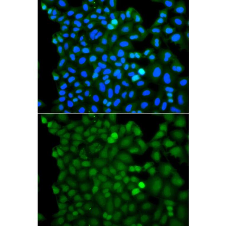 Immunofluorescence - Anti-RNF125 Antibody (A7982) - Antibodies.com