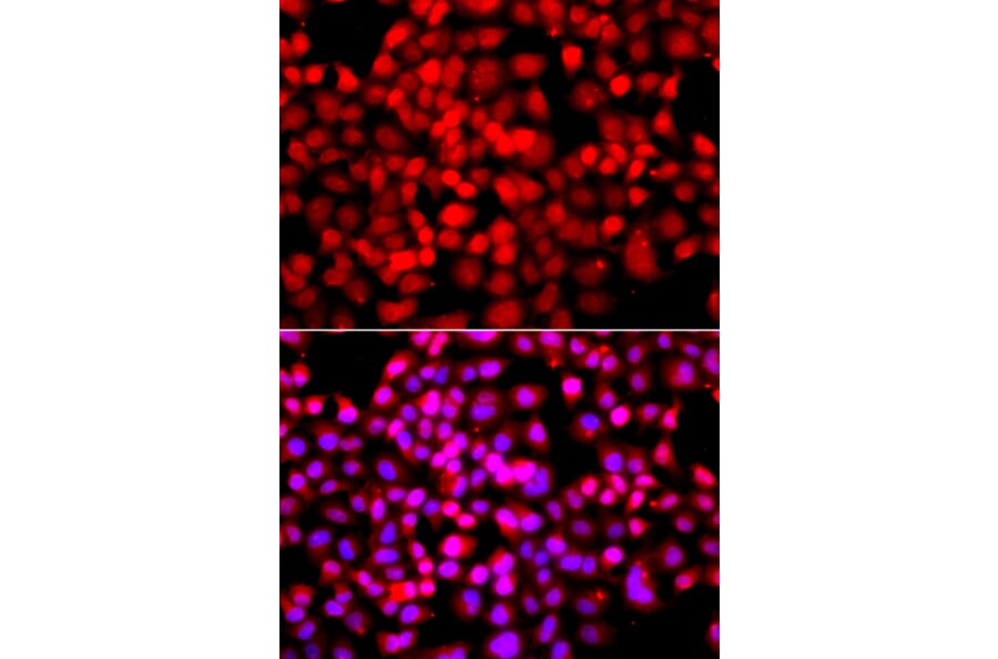Immunofluorescence - Anti-TDP1 Antibody (A7984) - Antibodies.com