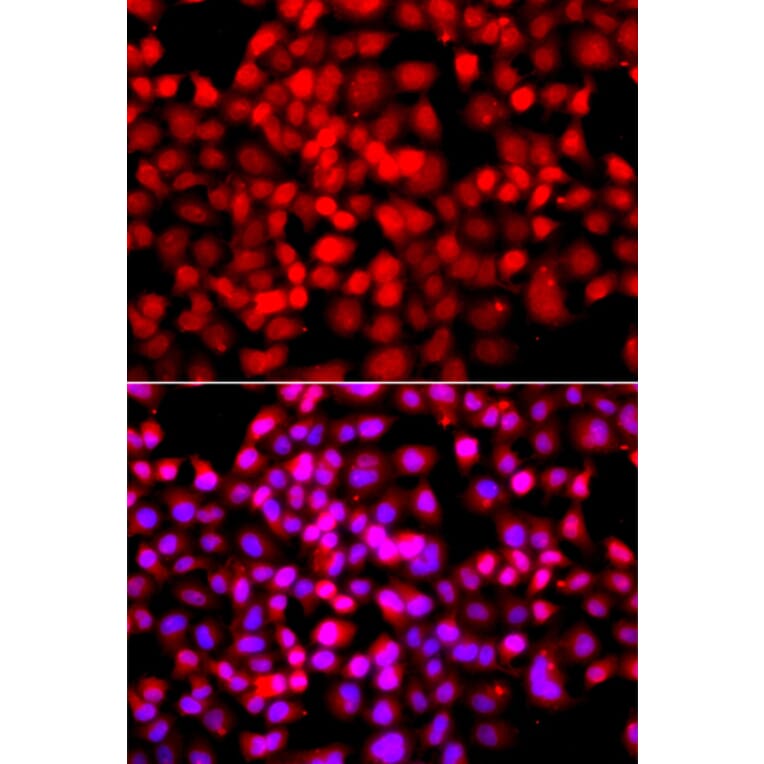 Immunofluorescence - Anti-TDP1 Antibody (A7984) - Antibodies.com