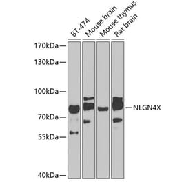 Western Blot - Anti-Neuroligin 4 Antibody (A10259) - Antibodies.com