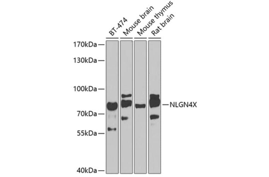 Western Blot - Anti-Neuroligin 4 Antibody (A10259) - Antibodies.com