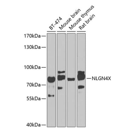 Western Blot - Anti-Neuroligin 4 Antibody (A10259) - Antibodies.com