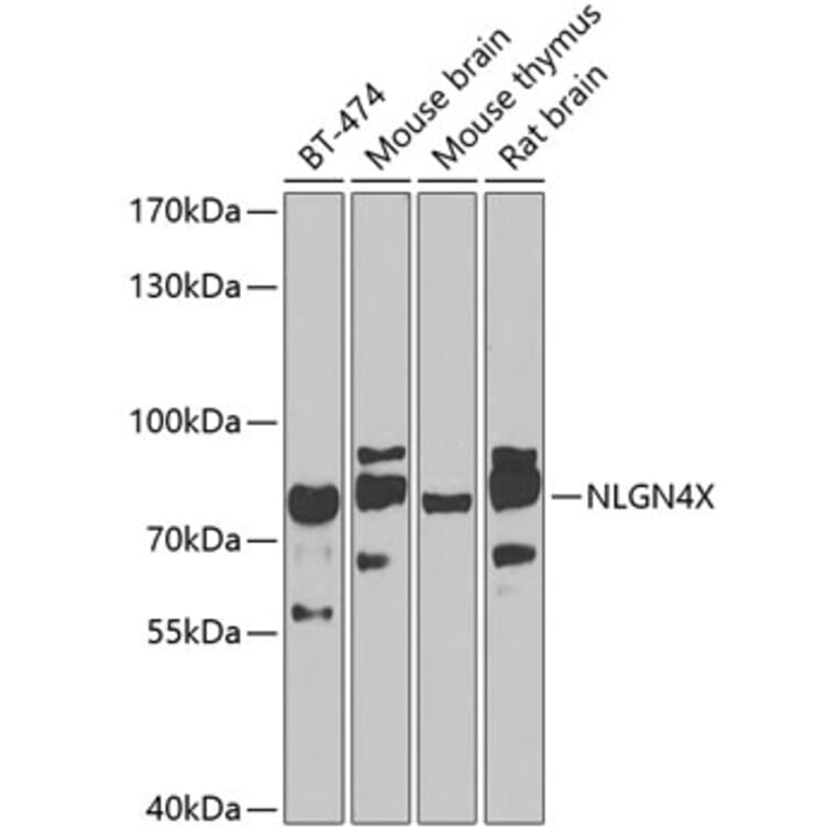 Western Blot - Anti-Neuroligin 4 Antibody (A10259) - Antibodies.com