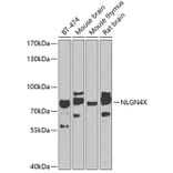 Western Blot - Anti-Neuroligin 4 Antibody (A10259) - Antibodies.com