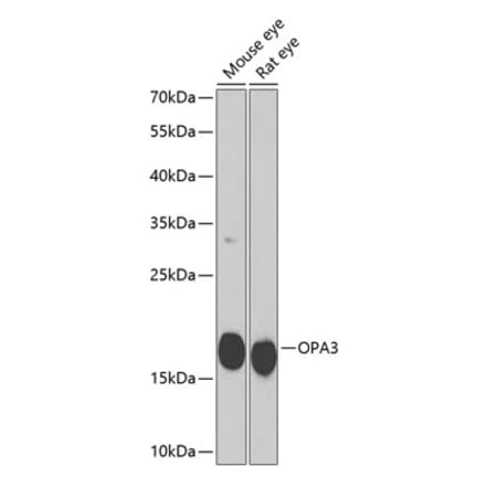 Western Blot - Anti-OPA3 Antibody (A10260) - Antibodies.com