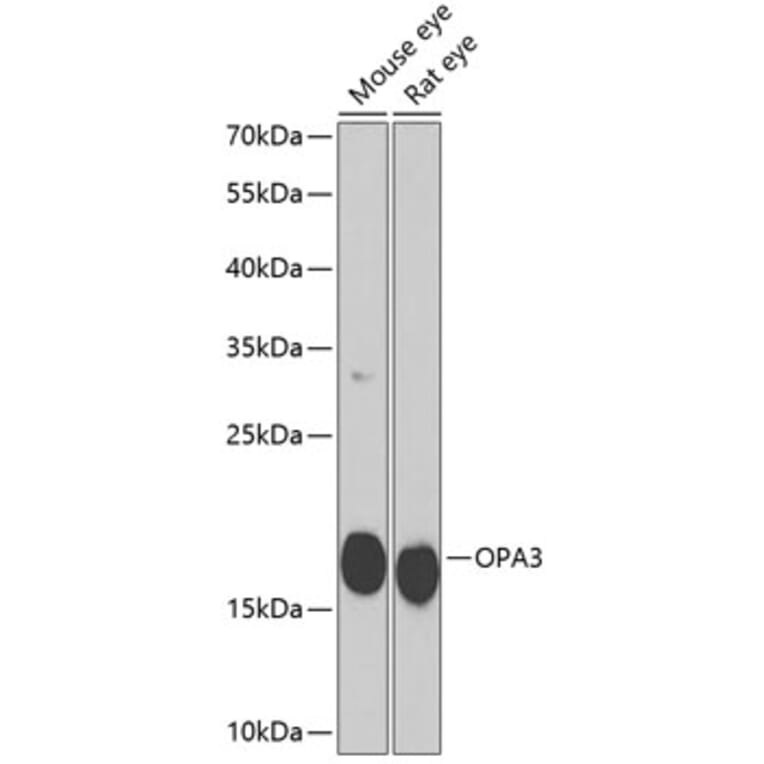 Western Blot - Anti-OPA3 Antibody (A10260) - Antibodies.com