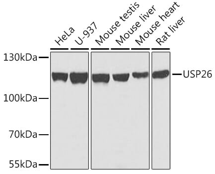 Western blot analysis of extracts of Mouse testis, using Anti-USP26 Antibody (A7999) at 1:1,000 dilution.
Secondary antibody: Goat Anti-Rabbit IgG (H+L) (HRP) (AS014) at 1:10,000 dilution.
Lysates / proteins: 25µg per lane.
Blocking buffer: 3% non-fat dry milk in TBST.
Detection: ECL Basic Kit (RM00020).
Exposure time: 1s.