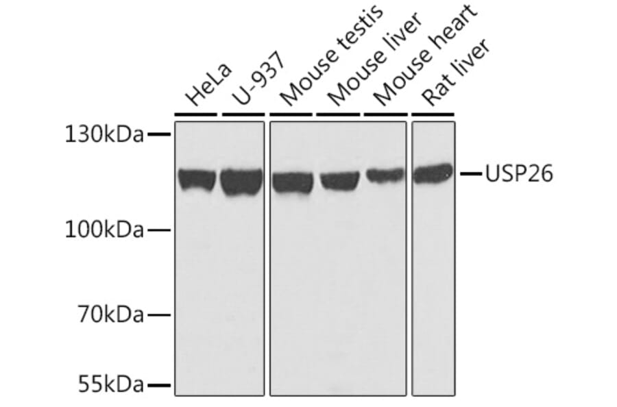 Western Blot - Anti-USP26 Antibody (A10261) - Antibodies.com