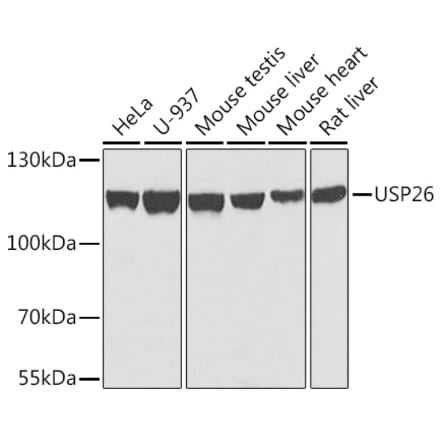 Western Blot - Anti-USP26 Antibody (A10261) - Antibodies.com