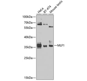 Western Blot - Anti-Myeloid leukemia factor 1 Antibody (A10262) - Antibodies.com