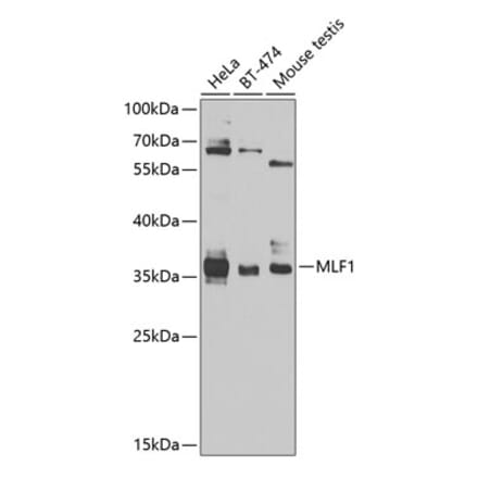 Western Blot - Anti-Myeloid leukemia factor 1 Antibody (A10262) - Antibodies.com