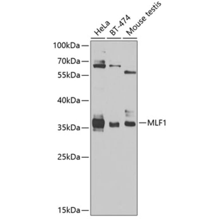 Western Blot - Anti-Myeloid leukemia factor 1 Antibody (A10262) - Antibodies.com