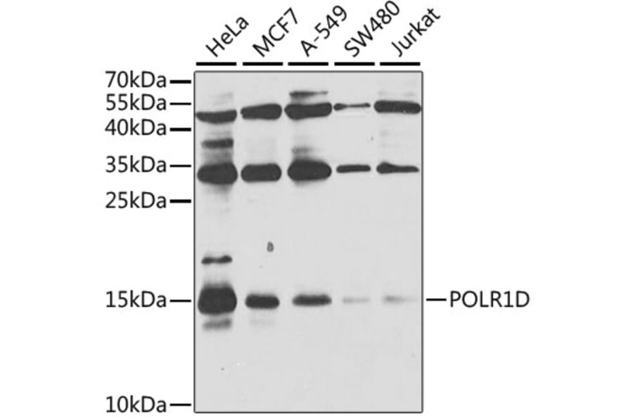 Western Blot - Anti-POLR1D Antibody (A8021) - Antibodies.com