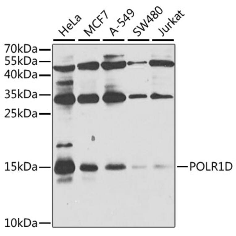 Western Blot - Anti-POLR1D Antibody (A8021) - Antibodies.com