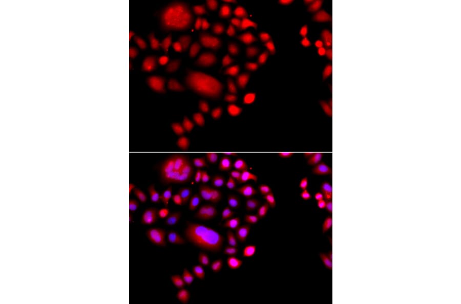 Immunofluorescence - Anti-POLR1D Antibody (A8021) - Antibodies.com