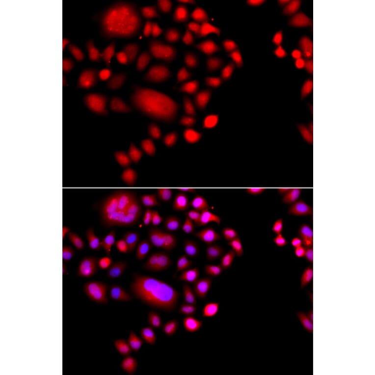 Immunofluorescence - Anti-POLR1D Antibody (A8021) - Antibodies.com