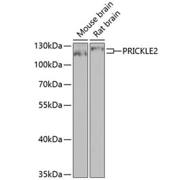 Western Blot - Anti-Prickle 2 Antibody (A10265) - Antibodies.com